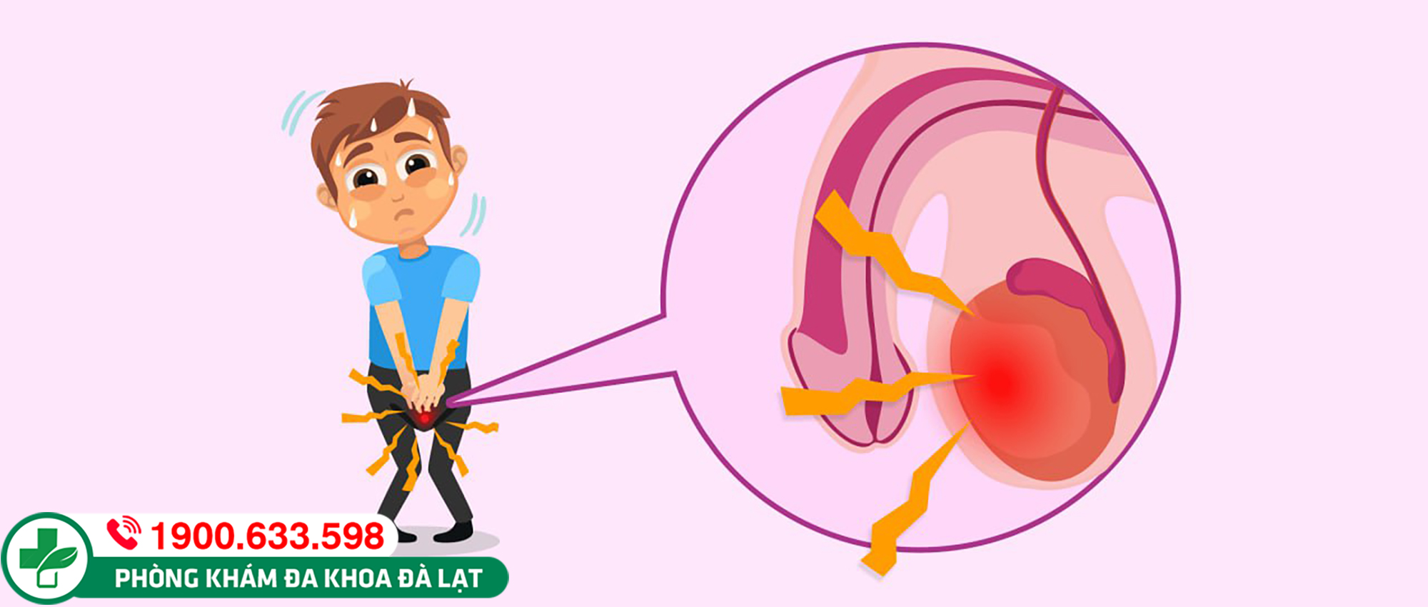  Nguyên Nhân, Dấu Hiệu của Hạch ở tinh hoàn? Những thông tin cần biết